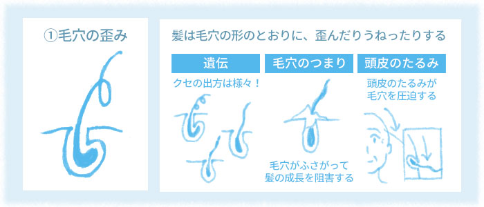 「くせ毛シャンプー」くせ毛の原因のひとつは「毛穴のゆがみ」