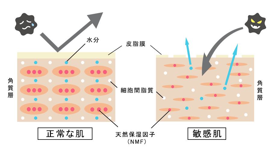 敏感肌の原因