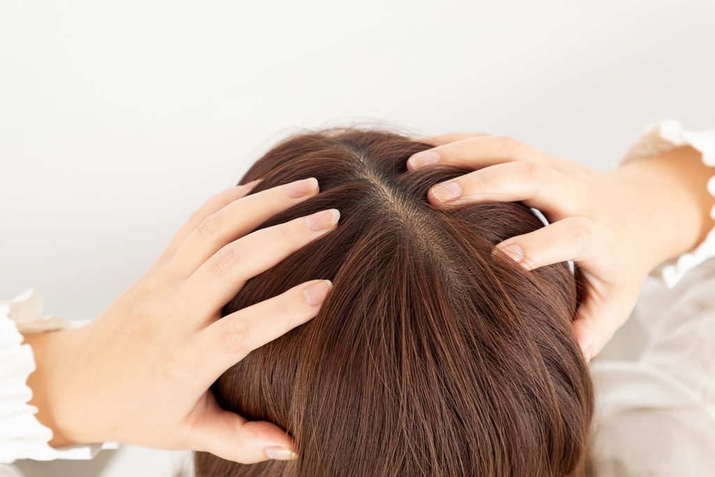 ���̖т��u�؂��񂱁v�ɂȂ錴���́H